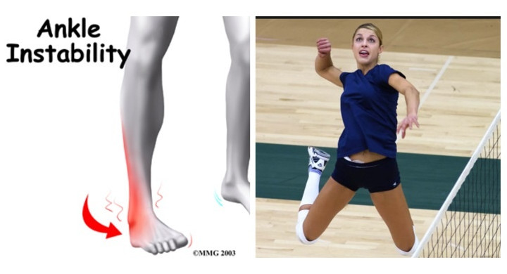 Volleyball Ankle Stability Exercises - Reids Workouts